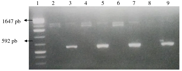 Gambar 2. Verifikasi hasil pengklonaan plasmid rekombinan dengan PCR menggunakan primer 