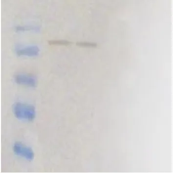 Gambar 4. Protein rekombinan NS1 purifikasi yang dideteksi dengan SDS- PAGE 12%. M: marker berat molekul  protein