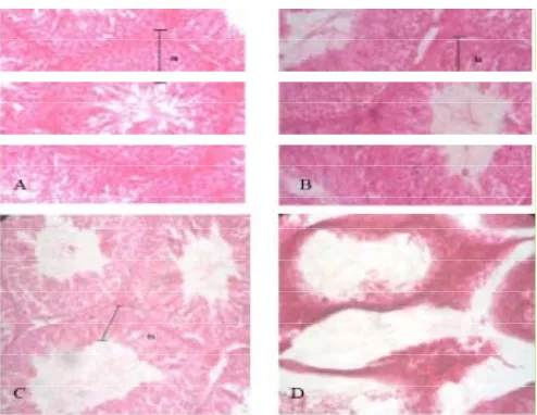 Gambar 2. Efek ekstrak etanol buah Flagellaria in-dica L. terhadap struktur histologi tubulus seminiferus mencit SW albino