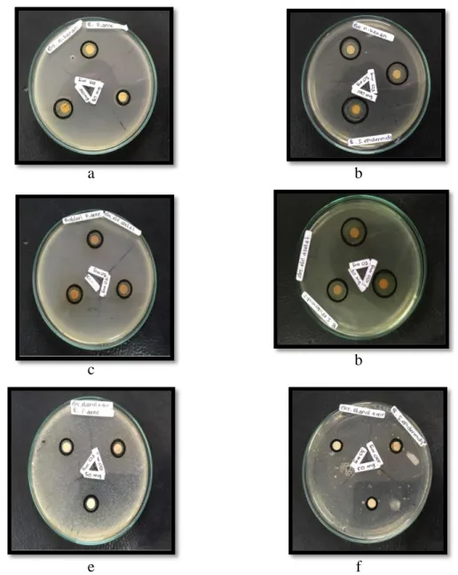 Gambar 5. (a) ekstrak n-heksan terdahap bakteri Propionibacterium acne, (b) ekstrak  n-heksan  terhadap  bakteri  Staphylococcus  epidermidis,  (c)  ekstrak  etil  asetat  terhadap  bakteri  Propionibacterium  acne,  (d)  ekstrak  etil  asetat  terhadap  b