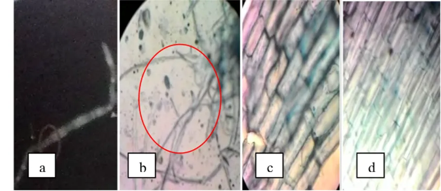 Gambar 4.7. Hifa F. oxysporum (a) Foto literatur (Sumber : Haris, 2005), (b)  Foto  pengamatan mikroskopis infeksi pada akar tomat perlakuan kontrol perbesaran 100x  (c) Foto pengamatan pada perlakuan ekstrak kulit jeruk C