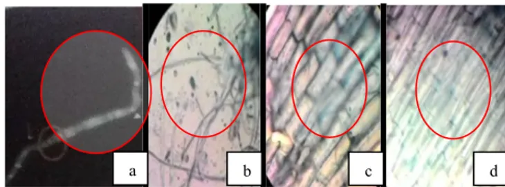 Gambar  2.  Hifa  F.  oxysporum  (a)  Foto  literatur  [14], (b)    Foto  pengamatan  mikroskopis  infeksi  pada  akar  tomat  perlakuan  kontrol  perbesaran  100x  (c)  Foto pengamatan pada perlakuan ekstrak kulit jeruk Pamelo pada konsentrasi  1%  perbes
