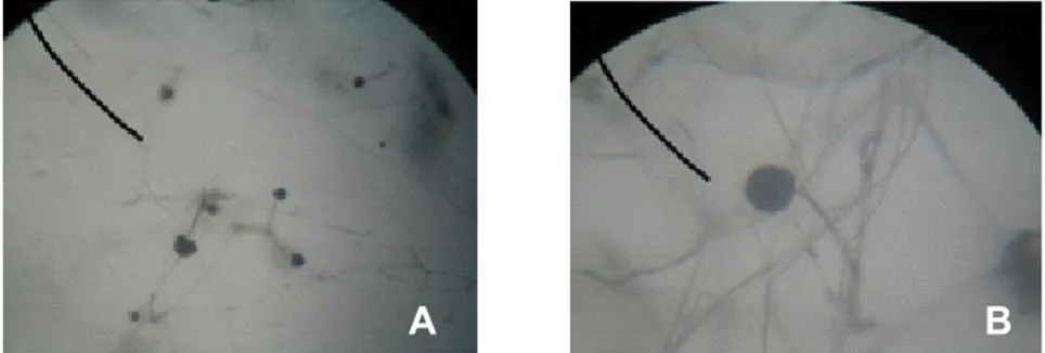 Gambar 3. Morfologi  mikroskopik  jamur  tempe,  hifa/stolon,  sporangiofor    dan  rizoid  (A),  Sporangium dan spora (B).