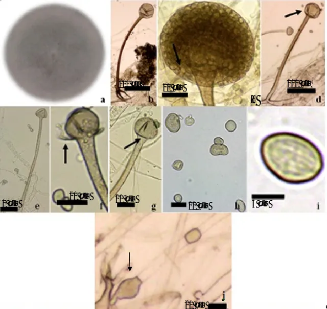 Gambar  1  Rhizopus  arrhizus  var.  delemar:  (a)  Koloni  berumur  3  hari  pada  33  °C,  (b)  Struktur  reproduksi aseksual dan rizoid, (c) Sporangium agak bulat, (d) Sporangiofor tumbuh dari  stolon  dengan  kolumela  agak  bulat  (panah),  (e)  Kolum