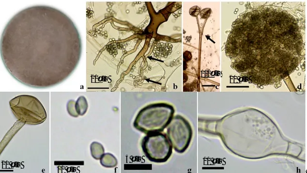 Gambar  2  Rhizopus  arrhizus  var.  tonkinensis:  (a)  Koloni  berumur  3  hari  pada  33  °C,  (b)  Rizoid  bercabang  (panah),  (c)  Sporangiofor  bercabang  (panah),  (d)  Sporangium  membulat,  (e)  Kolumela  bulat  mengerucut,  (f)  Sporangiospora  s