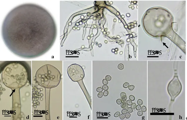 Gambar  3  Rhizopus  microsporus  var.  chinensis:  (a)  Koloni  berumur  3  hari  pada  suhu  33  °C,  (b)  Rizoid,  (c)  Kolumela  membulat  dengan  kolar  (panah),  (d)  Kolumela  agak  bulat  dengan  apofisis (panah), (e) Kolumela bulat mengerucut, (f)