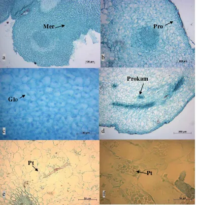 Gambar 4.6.  Analisis Histologi Embrio Somatik Dari Segmen Basal Apikal Bud Kelapa Sawit Fase Globular (a) potongan jaringan kalus friabel yang terdiri dari sel-sel yang bersifat meristematik pada segmen basal (b) jaringan protoderm (c) jaringan meristem y