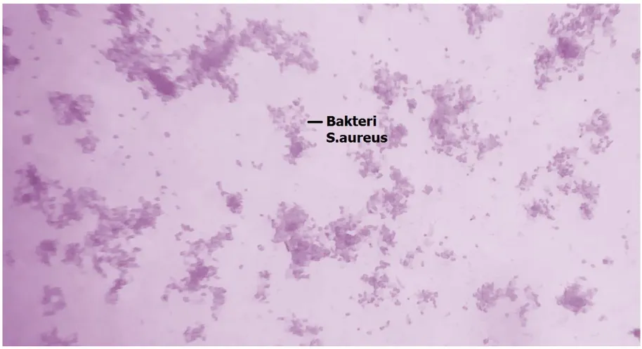 Gambar 1 morfologi hasil pewarnaan gram dengan mikroskop pembesaran 40x 