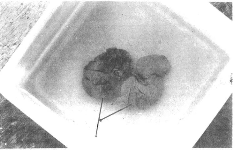 Figure 2. Livers of test rats fed 10% Gneturn gnernon. Note few to numerous streaks and patches of haemorr- hage (darker areas) in the parietal surface of the liver lobes (Formalin fixed and immerged in water)