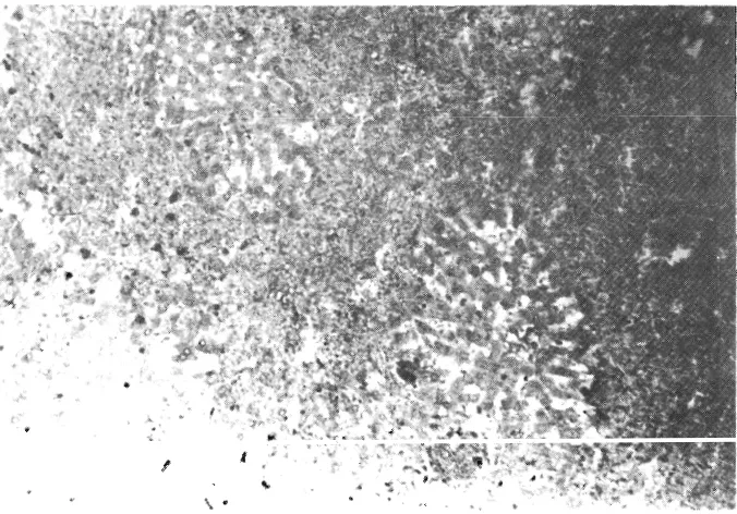 Figure 3. Liver of rat fed 10% Gnetum gnemon. Note difuse perilobular coagulative necrosis of hepatic cells