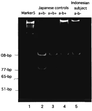 Figure 3. The second PCR using oligonucleotides gpFy-535 and gpFy-279 with a restriction enzyme 