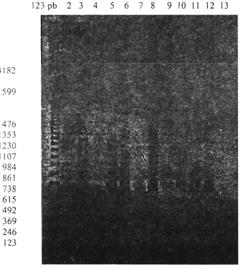 Gambar 1. Elektroferogram Hasil PCR dengan Primer OPE 17 pada An. barbirostris Berasal 