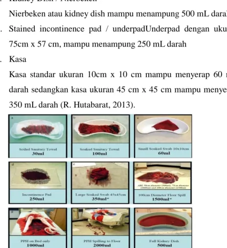 Gambar 1 Estimasi Kehilangan Darah ( R. Hutabarat, 2013) 