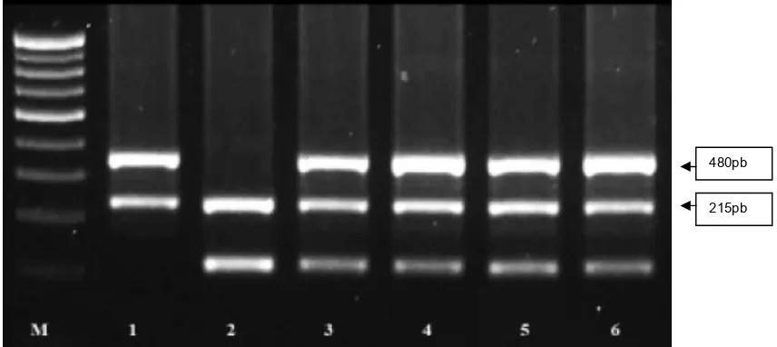 Gambar 1. Analisis PCR gen GSTT1 dan GSTM1 (pita kolom M merupakan marker, kolom 1 genotip GSTT1 nul sebesar 480 pb, kolom 2 merupakan genotip gen GSTM1 nul sebesar 215pb).