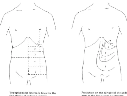 Fig. 3. Classification of spleen sizes according to Hackett's method. (WHO. 1963. Terminology of 