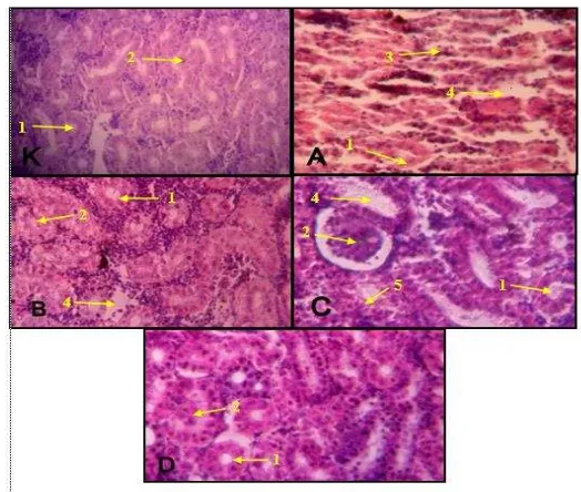 Gambar 2. Perbandingan profil histopatologi ginjal Kakap Putih dengan pewarnaan H-E perbesaran 400x