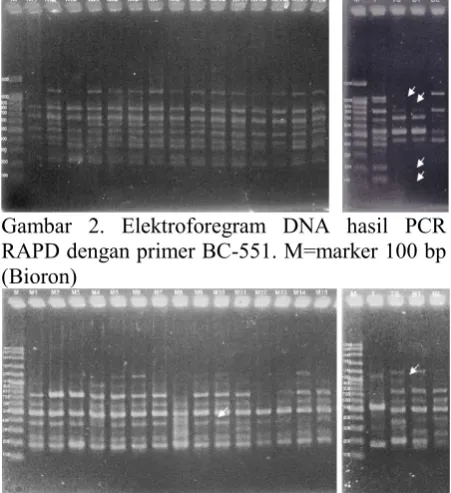 Gambar 2. Elektroforegram DNA hasil PCR