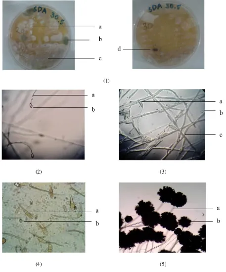Gambar 2. (1) Koloni jamur a. Phytopthora infestans, b. Alternaria solani, c. Fusarium oxysporum, d