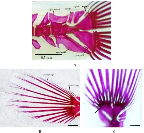Gambar 2.Elemen sirip kaudal dan lepidotricia P. gracilis. A. Letak os parhypural dan epural, anak panahmenunjukan letak zygapophysis pada os hypural; B