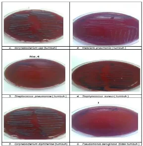 Gambar 1. Hasil pertumbuhan beberapa bakteri yang tumbuh dan mempunyai warna  koloni yang hampir sama: hitam atau keabuan ( gambar 1.1 – 1.5) serta yang tidak tumbuh (gambar 1.6) pada medium CTBA 