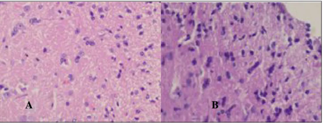 Gambar 4  Irisan Melintang  Dorsal Horn  dari  Spinal Cord  Mencit Kelompok Sham  (A) dan  Kelompok CFA (B) menggunakan Pewarnaan Haematoxylin Eosin perbesaran 400  kali