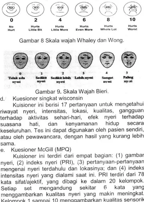 Gambar  B  Skala  wajah  Whaley  dan Wong.