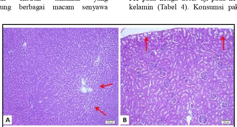 Gambar 1. Gambaran kerusakan/lesi histopatologi organ hati dan ginjal hewan  dengan perlakuan FH Dosis 1