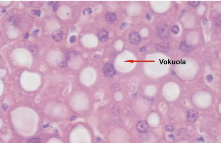 Gambar 3. Penampang melintang hepar R. norvegicus infektif Leptospira sp. pada perbesaran 1000 x