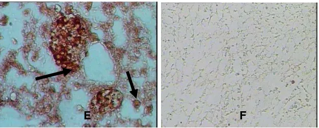 Gambar 5. Antigen virus virus HPAI H5N1 isolat unggas air pada organ-organ embrio. (A) Glomerulus, (C) Intestinum, (E) Paru-paru