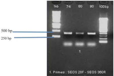 Figure 1. Primer SEOS 28F – SEOS 360R