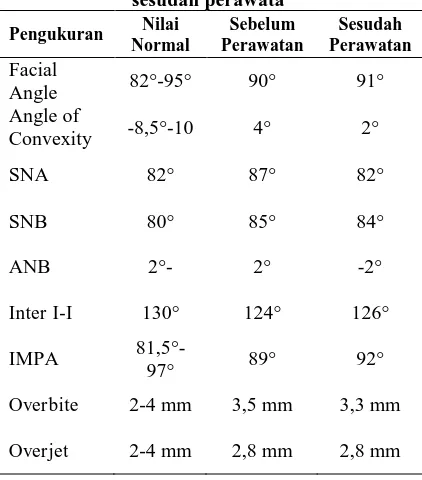 Tabel 1. Pengukuran sefalometri sebelum dan sesudah perawata 