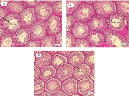Gambar 2.  Fotomikrograf Tubulus Seminiferus Kelompok Kontrol (K0), Puasa 10 Jam (K1) dan Puasa 12 Jam (K2) Perbesaran 100x dengan Pewarnaan HE 