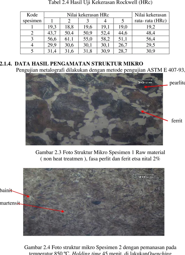 Gambar 2.3 Foto Struktur Mikro Spesimen 1 Raw material   ( non heat treatmen ), fasa perlit dan ferit etsa nital 2% 