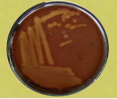Gambar 4. Morfologi bakteri SGB dengan pewarnaan Gram yang diamati dengan mikroskop. 