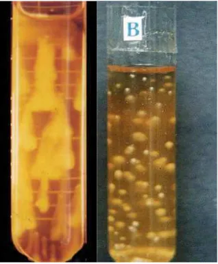 Gambar 5. Pola pertumbuhan bakteri SGB pada media cair; jernih dengan endapan di dasar tabung (A) dan keruh (B)