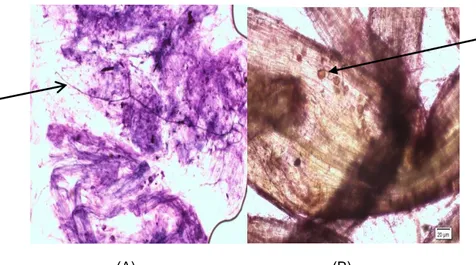 Gambar 3. Penampang Akar Tanaman Kedelai yang Terinfeksi Mikoriza;(A) Hifa internal pada Akar, (B)  Vesikula Mikoriza dalam Akar