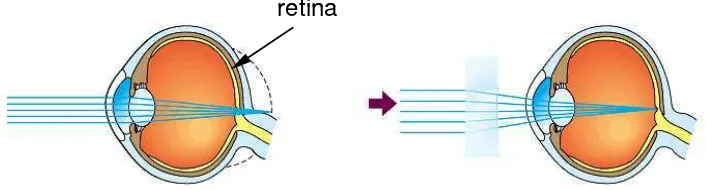 Gambar di bawah ini menunjukkan proses jatuhnya bayangan benda pada mata sehingga 