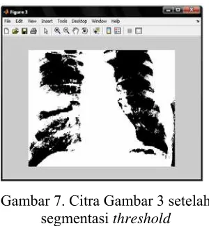 Gambar 7. Citra Gambar 3 setelah 