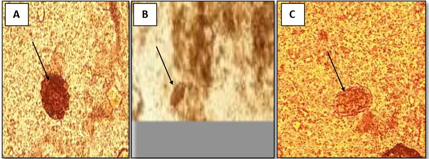Gambar 1. Hasil pengamatan dengan menggunakan NaCl 0,9 % dengan perbesaran 40 X. A. Telur Ascaris lumbricoides; B