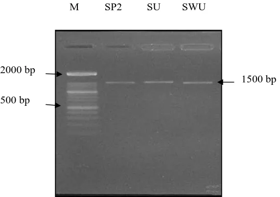 Gambar 1. Hasil amplifikasi DNA- PCR universal pada gel agarose 