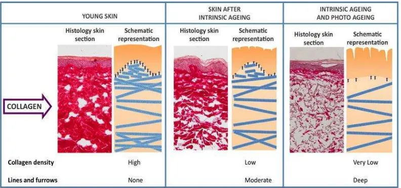 Gambar 2.7 Perubahan Histopatologi pada Kulit  Photoaging (Naylor, 2011) 