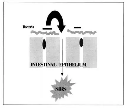 Gambar 5.  Gangguan pada mukosa usus dan  awal dari systemic inflammatory response syndrome: hipotesis bahwa barrier usus dilindungi oleh glutamine  