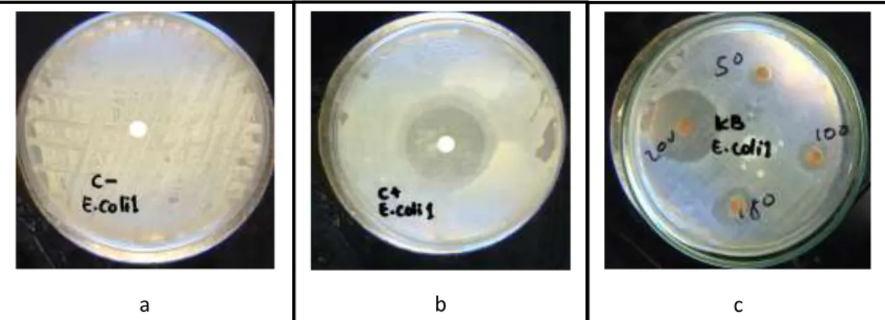 Gambar 4. Hasil uji ekstrak etanol kulit batang M. odorata Griff terhadap bakteri E. coli ATCC   25922:  a