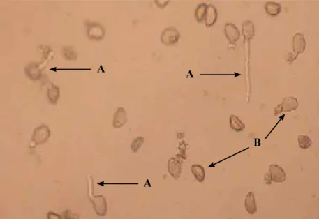 Gambar 3.   Serbuk sari yang berkecambah (A) dan serbuk sari yang tidak  berkecambah (B) (The germinated 