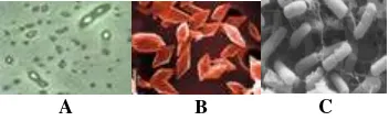 Gambar 2. Bacillus thuringiensis (Scimat.com 2001) A. Visualisasi Bt melalui mikroskop fase kontras, sel vegetatif mengandung endospora (fase terang)