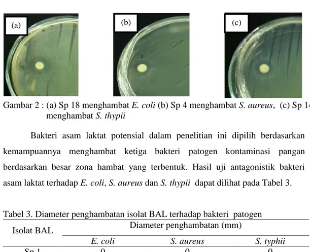 Gambar 2 : (a) Sp 18 menghambat E. coli (b) Sp 4 menghambat S. aureus,  (c) Sp 14  menghambat S