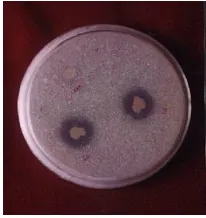 Gambar 01. Pelarutan fosfat oleh mikroba (Isroi, 2005)  
