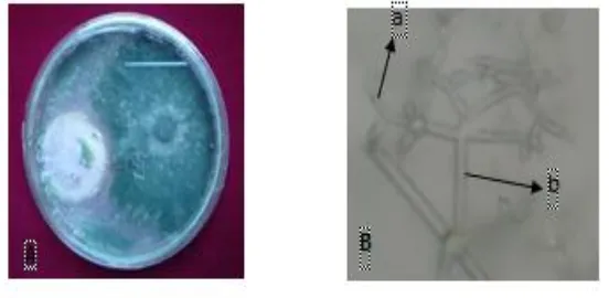 Gambar 5. Makroskopis dan mikroskopis jamur Trichodermasp.A : Makroskopis jamurTrichoderma sp