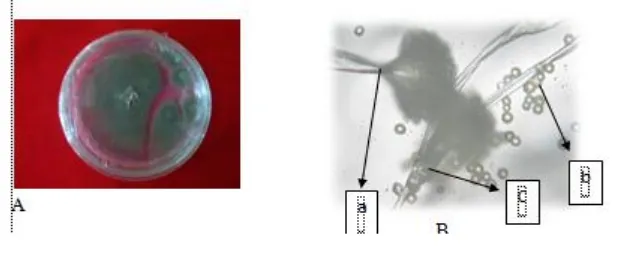 Gambar 6. Makroskopis dan mikroskopis jamur Aspergillus .A : Makroskopis jamur
