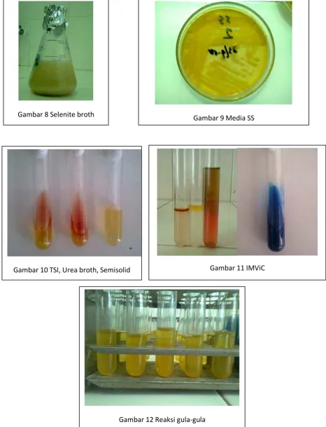 Gambar 8 Selenite broth  